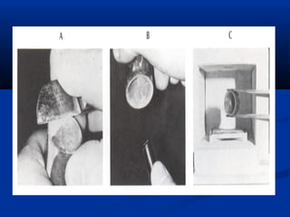 Spruing and investing