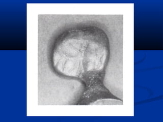 Spruing and investing