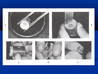 Spruing and investing