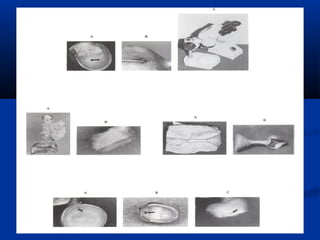 Spruing and investing