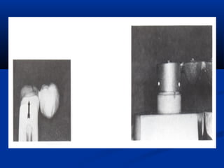 Spruing and investing