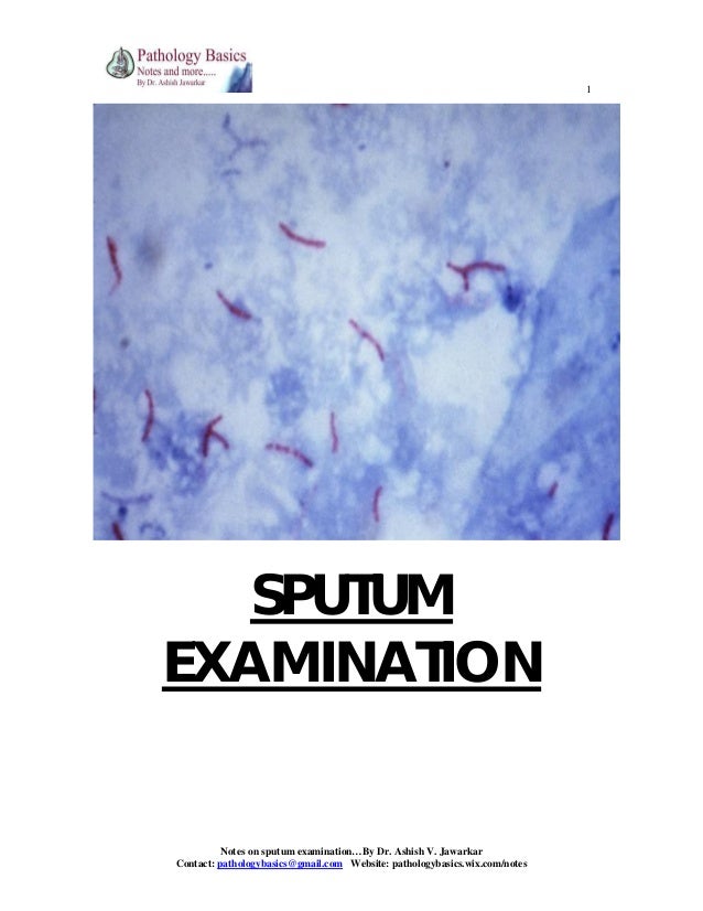 sputum examination sputum test