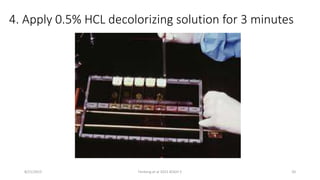 4. Apply 0.5% HCL decolorizing solution for 3 minutes
8/21/2015 Fenteng et al 2015 KOGH 5 20
 