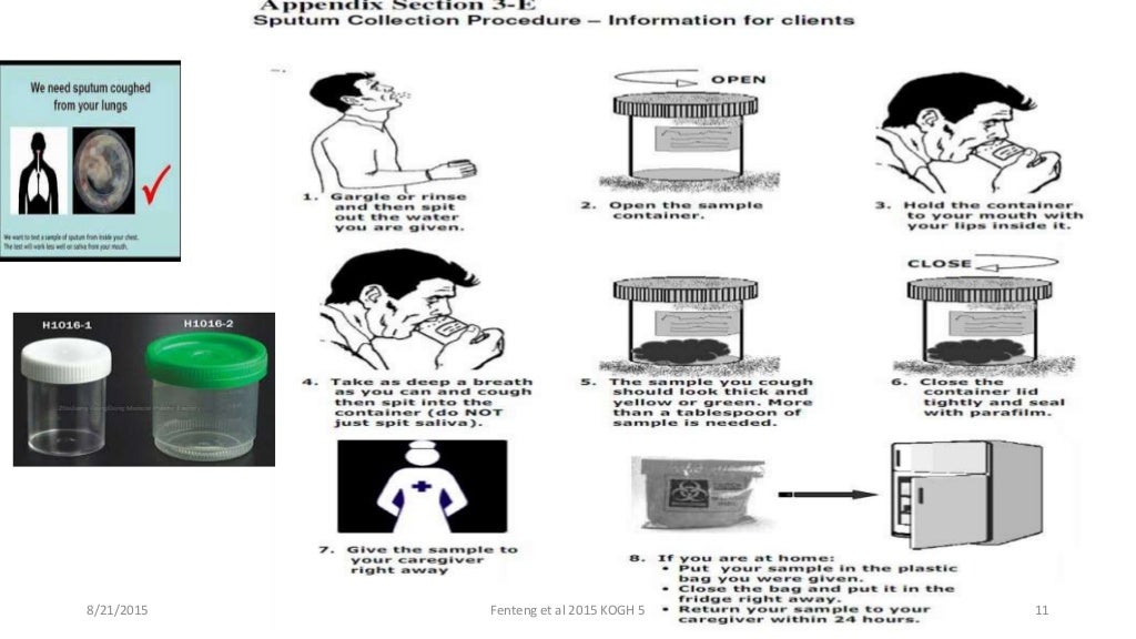 Sputum Examination and Analysis