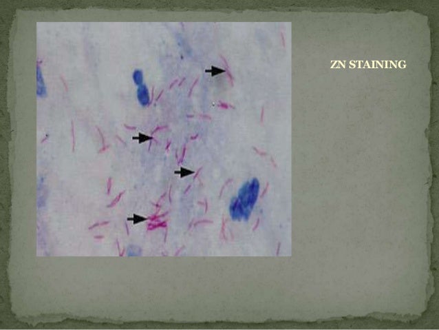 auramine staining 13