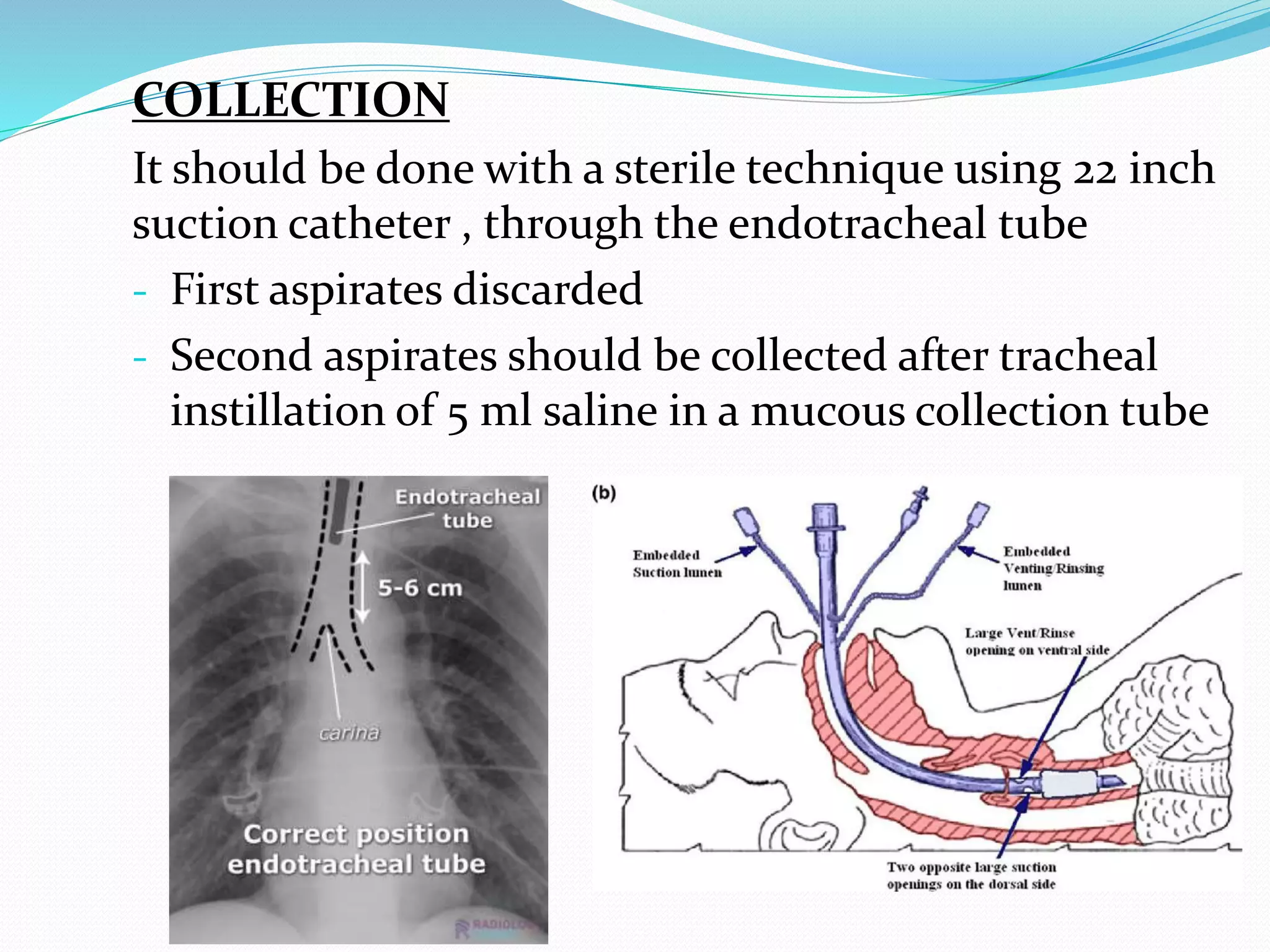 COLLECTION
It should be done with a sterile technique using 22 inch
suction catheter , through the endotracheal tube
- First aspirates discarded
- Second aspirates should be collected after tracheal
instillation of 5 ml saline in a mucous collection tube
 