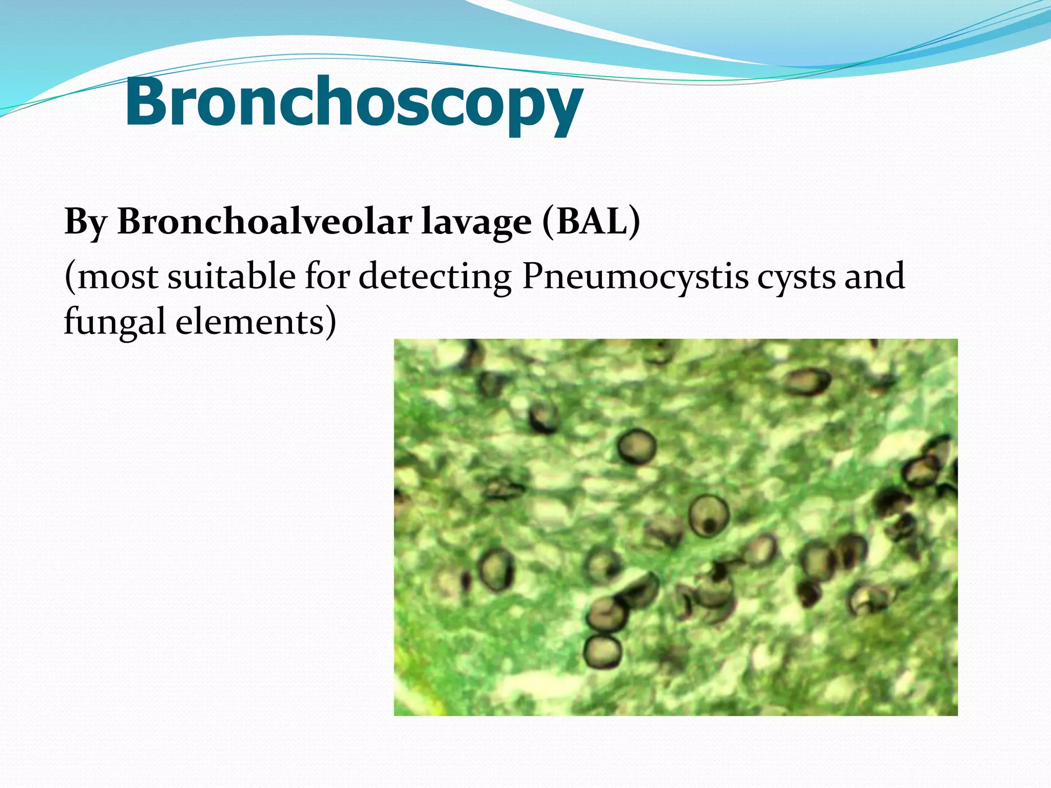 Bronchoscopy
By Bronchoalveolar lavage (BAL)
(most suitable for detecting Pneumocystis cysts and
fungal elements)
 