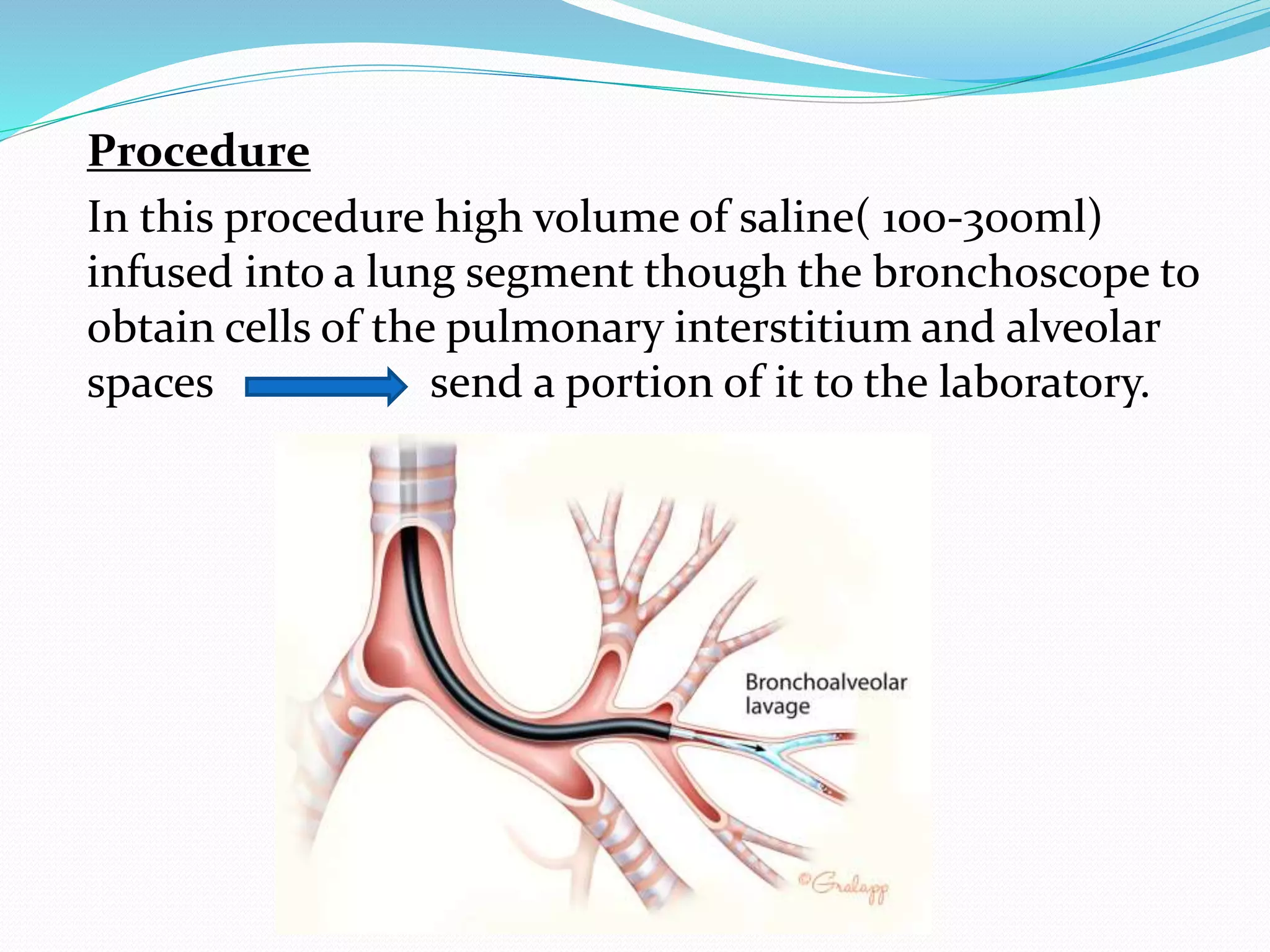 Procedure
In this procedure high volume of saline( 100-300ml)
infused into a lung segment though the bronchoscope to
obtain cells of the pulmonary interstitium and alveolar
spaces send a portion of it to the laboratory.
 