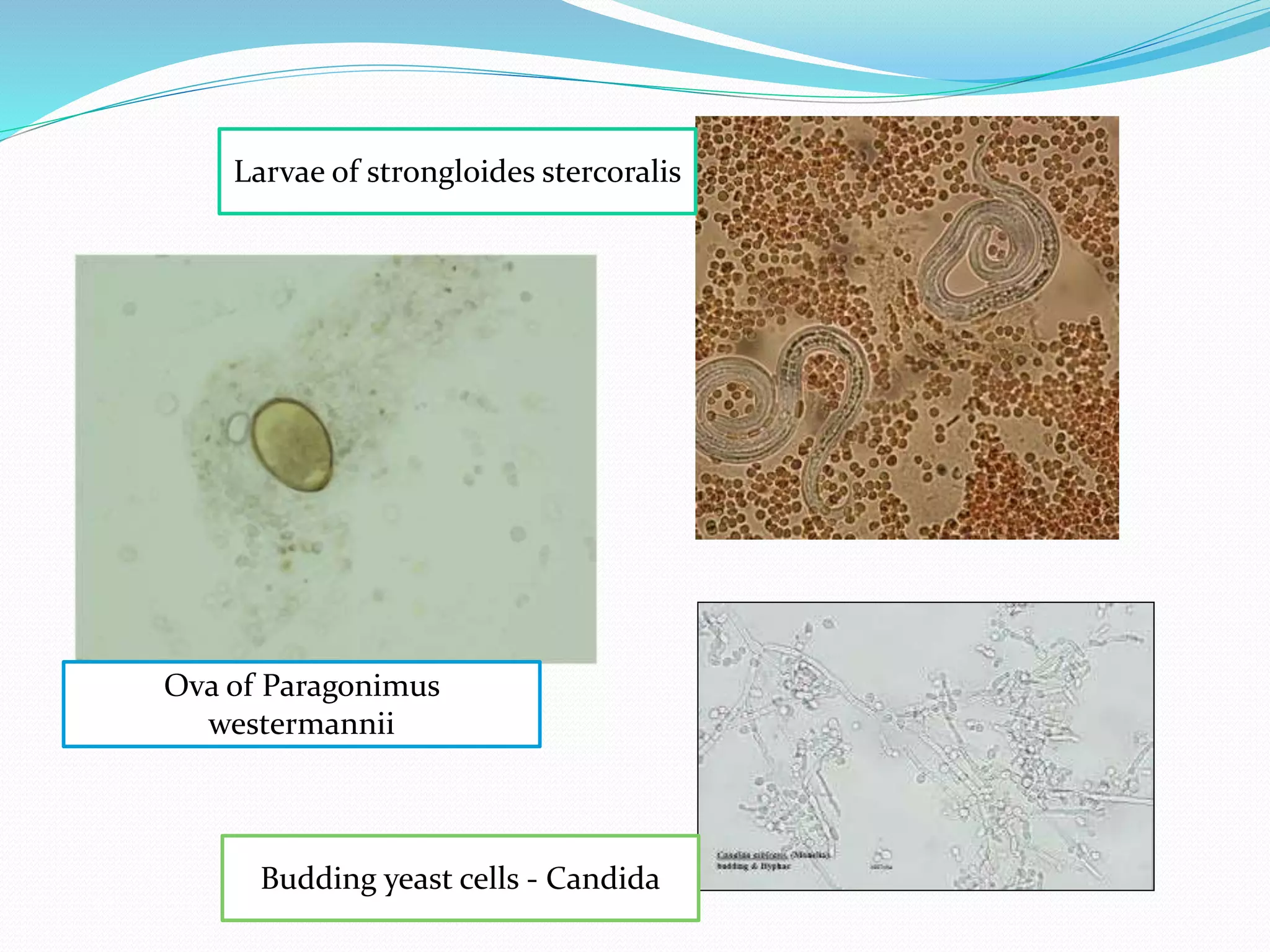 Ova of Paragonimus
westermannii
Budding yeast cells - Candida
Larvae of strongloides stercoralis
 