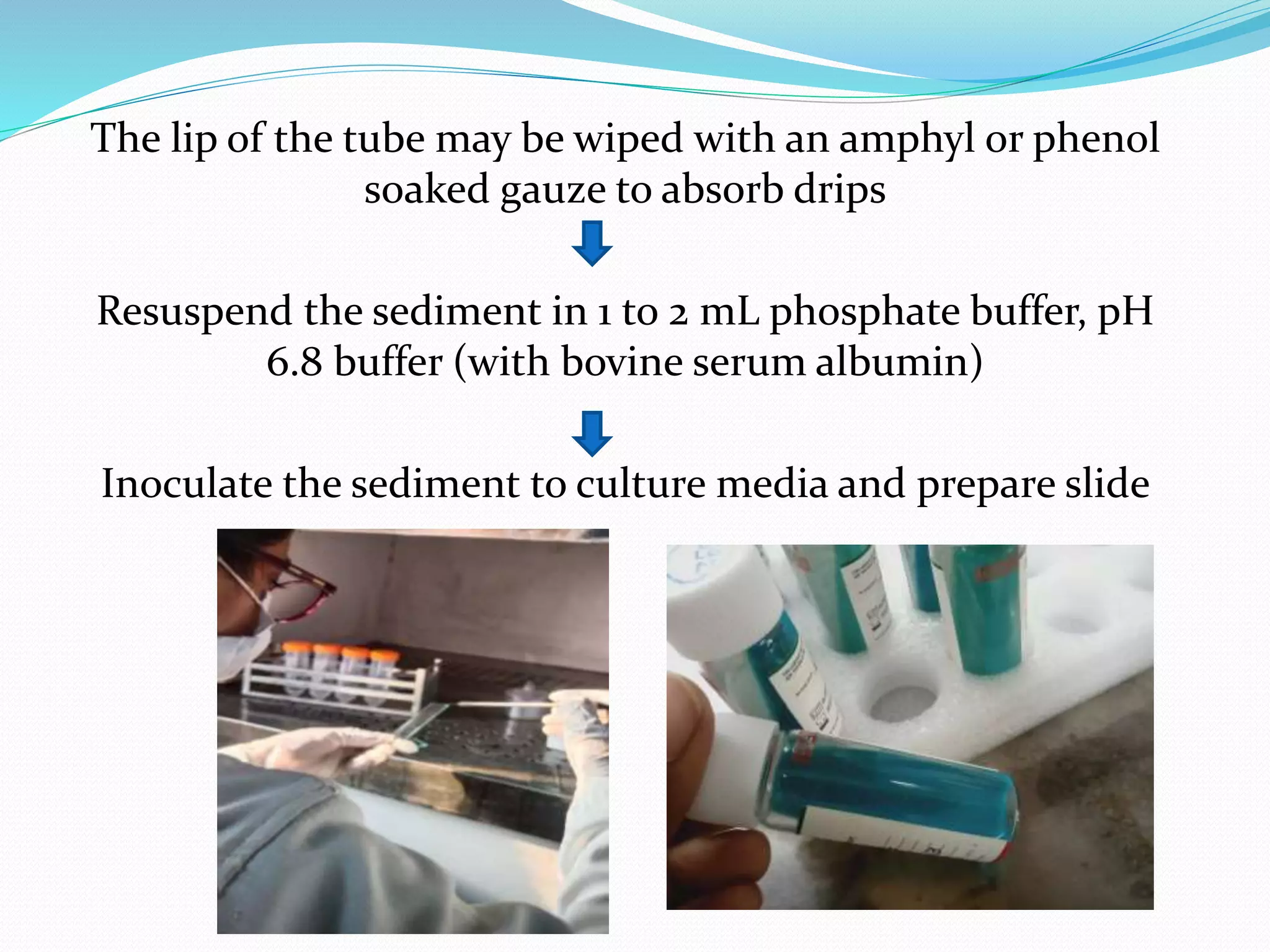 The lip of the tube may be wiped with an amphyl or phenol
soaked gauze to absorb drips
Resuspend the sediment in 1 to 2 mL phosphate buffer, pH
6.8 buffer (with bovine serum albumin)
Inoculate the sediment to culture media and prepare slide
 