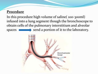 Procedure
In this procedure high volume of saline( 100-300ml)
infused into a lung segment though the bronchoscope to
obtain cells of the pulmonary interstitium and alveolar
spaces send a portion of it to the laboratory.
 