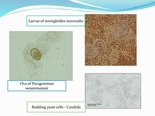 Ova of Paragonimus
westermannii
Budding yeast cells - Candida
Larvae of strongloides stercoralis
 