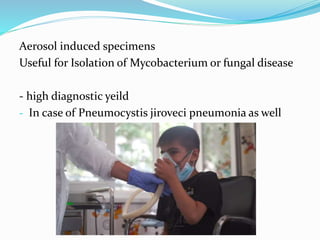 Aerosol induced specimens
Useful for Isolation of Mycobacterium or fungal disease
- high diagnostic yeild
- In case of Pneumocystis jiroveci pneumonia as well
 