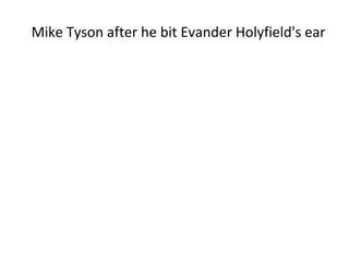 Mike Tyson after he bit Evander Holyfield's ear 