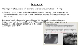 Diagnosis
The diagnosis of squamous cell carcinoma involves various methods, including:
1. Biopsy: A tissue sample is taken from the suspicious area (e.g., skin, oral cavity) and
examined under a microscope to look for the characteristic features of squamous cell
carcinoma.
2. Imaging studies: Depending on the location and extent of the suspected cancer,
imaging tests such as X-rays, CT scans, MRI scans, or PET scans may be performed to
evaluate the size, location, and spread of the cancer.
3. Histopathogical study
 