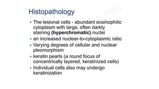 Squamous cell carcinoma.pptxpresentation