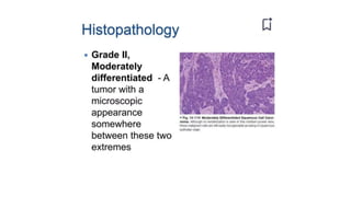 Squamous cell carcinoma.pptxpresentation