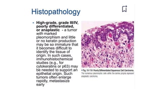 Squamous cell carcinoma.pptxpresentation