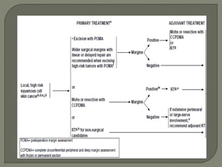 Squamous cell carcinoma skin