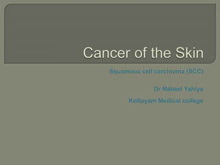 Squamous cell carcinoma (SCC)
Dr Nabeel Yahiya
Kottayam Medical college
 