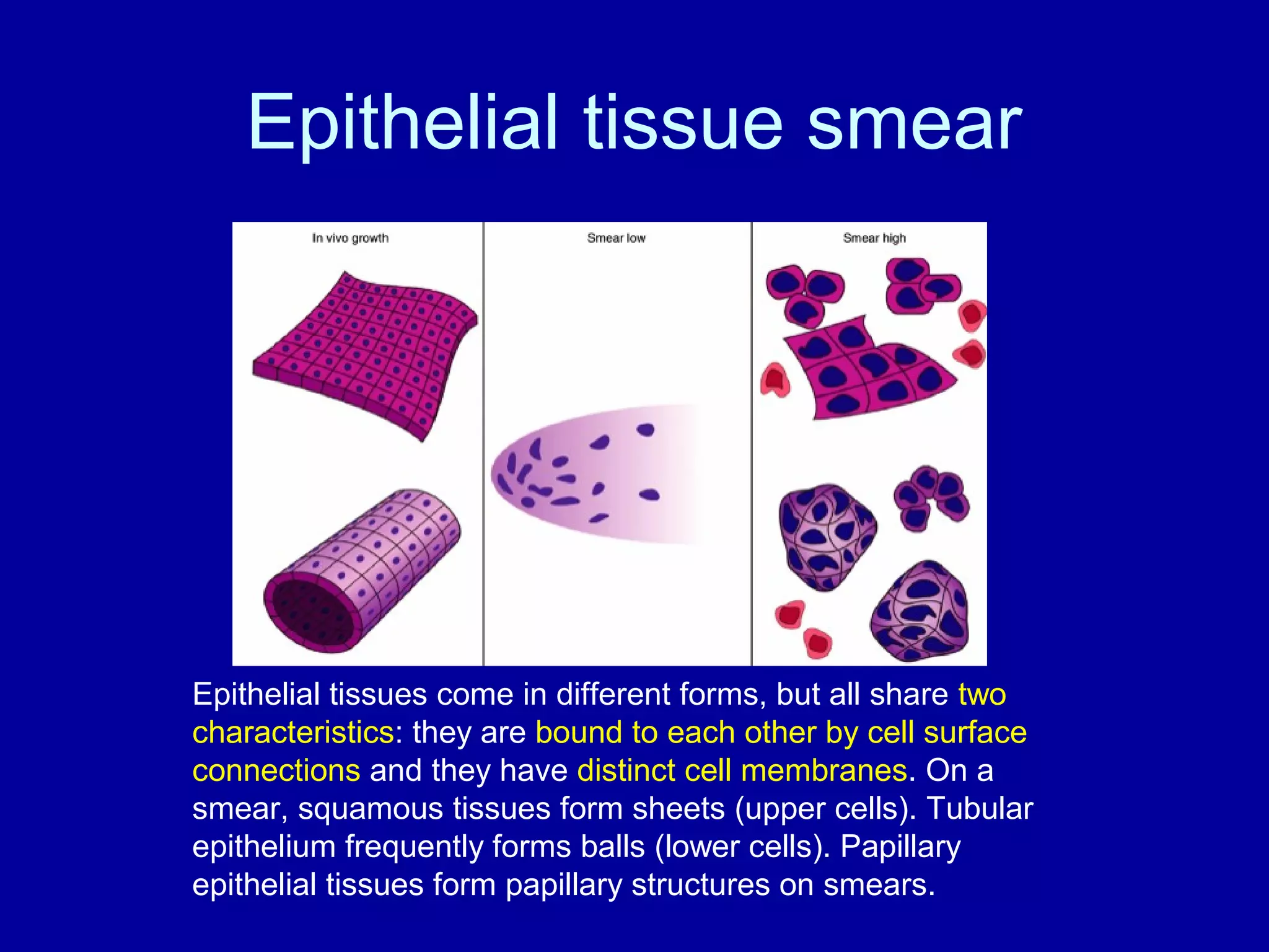 Squash cytology of cns paediatric tumours | PPT