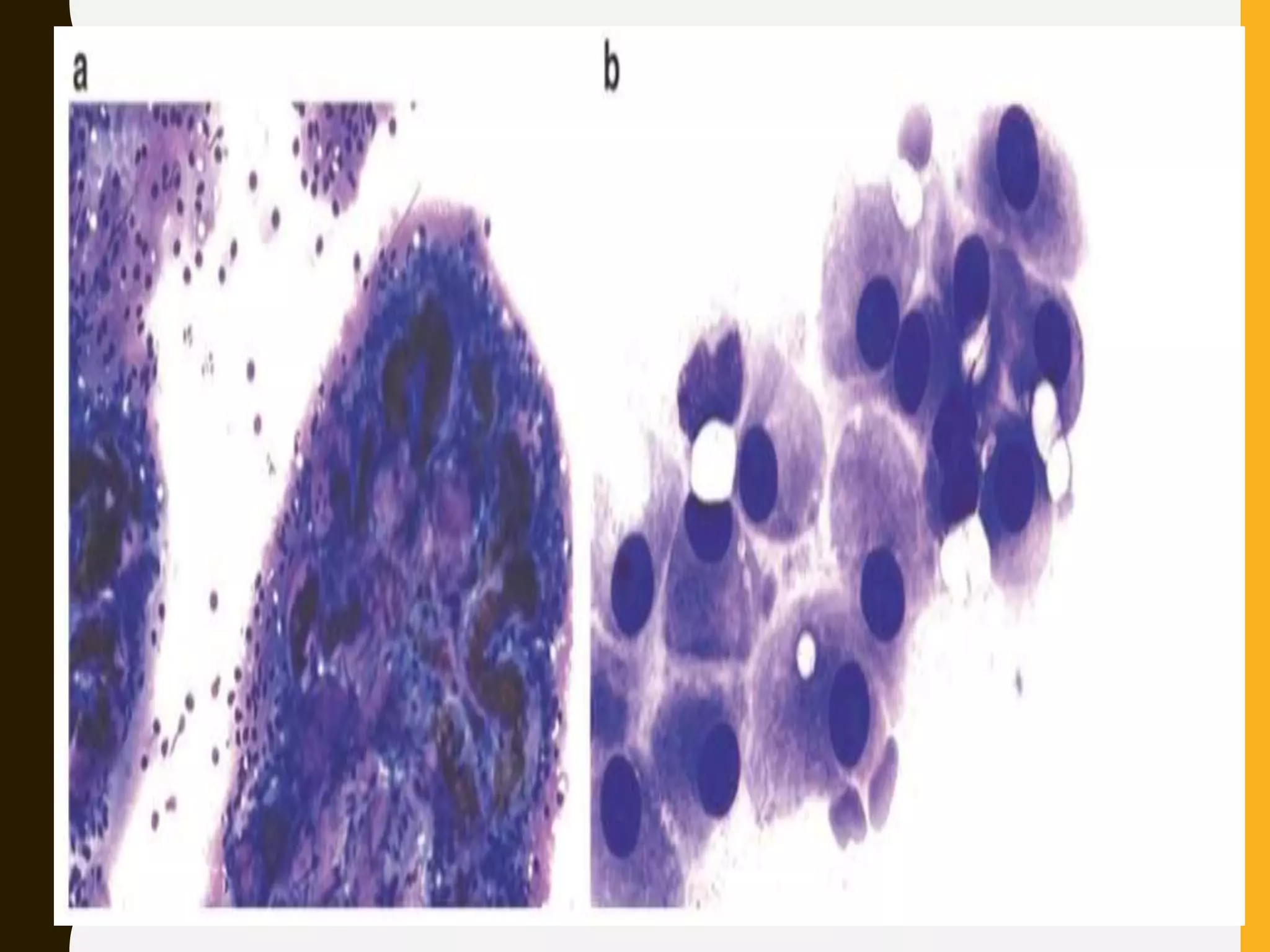 Squash smear cytology - By Anamika dev | PPTX