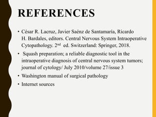 REFERENCES
• César R. Lacruz, Javier Saénz de Santamaría, Ricardo
H. Bardales, editors. Central Nervous System Intraoperative
Cytopathology. 2nd ed. Switzerland: Springer, 2018.
• Squash preparation; a reliable diagnostic tool in the
intraoperative diagnosis of central nervous system tumors;
journal of cytology/ July 2010/volume 27/issue 3
• Washington manual of surgical pathology
• Internet sources
 