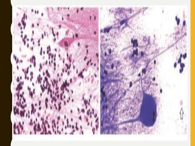 Squash smear cytology - By Anamika dev | PPTX