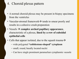 4. Choroid plexus pattern
• A normal choroid plexus may be present in biopsy specimens
from the ventricles
• Vascular-stromal framework tends to smear poorly and
results in a cohesive crush preparation
• Vessels  complex arched papillary appearance,
characteristic of a plexus, lined by a row of cuboidal
epithelial cells
• Cells that appear isolated, due to the squash trauma
– wide polygonal “cobblestone-shaped” cytoplasm
– small, round, basally located nuclei
– Can have single prominent paranuclear cytoplasmic vacuole
 