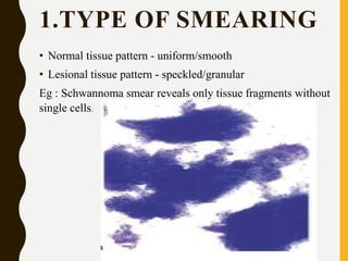 1.TYPE OF SMEARING
• Normal tissue pattern - uniform/smooth
• Lesional tissue pattern - speckled/granular
Eg : Schwannoma smear reveals only tissue fragments without
single cells.
 