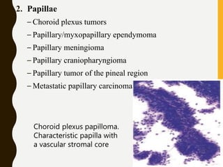 2. Papillae
– Choroid plexus tumors
– Papillary/myxopapillary ependymoma
– Papillary meningioma
– Papillary craniopharyngioma
– Papillary tumor of the pineal region
– Metastatic papillary carcinomas
Choroid plexus papilloma.
Characteristic papilla with
a vascular stromal core
 