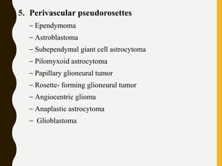 5. Perivascular pseudorosettes
– Ependymoma
– Astroblastoma
– Subependymal giant cell astrocytoma
– Pilomyxoid astrocytoma
– Papillary glioneural tumor
– Rosette- forming glioneural tumor
– Angiocentric glioma
– Anaplastic astrocytoma
– Glioblastoma
 