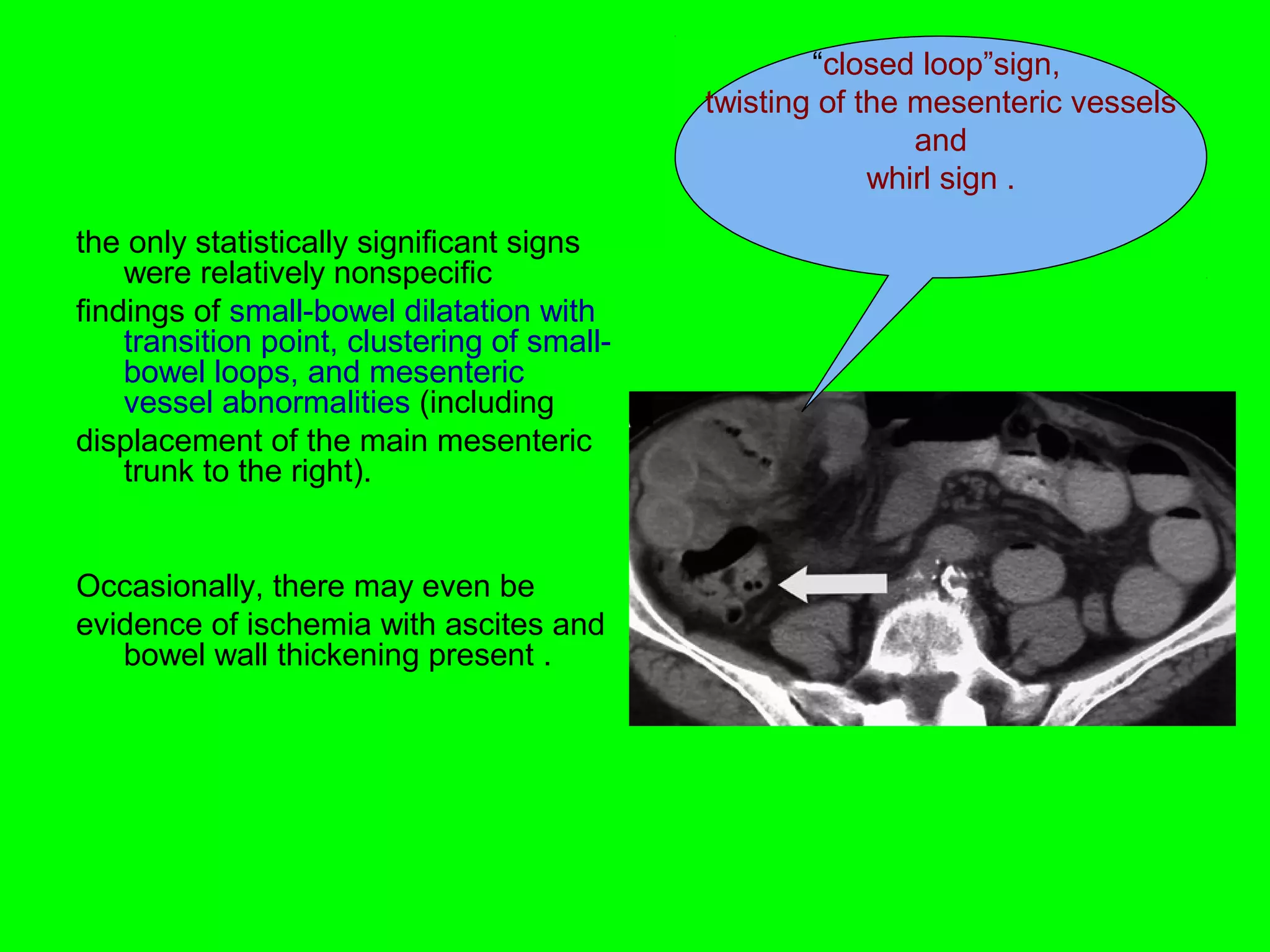 the only statistically significant signs 
were relatively nonspecific 
findings of small-bowel dilatation with 
transition point, clustering of small-bowel 
loops, and mesenteric 
vessel abnormalities (including 
displacement of the main mesenteric 
trunk to the right). 
Occasionally, there may even be 
evidence of ischemia with ascites and 
bowel wall thickening present . 
“closed loop”sign, 
twisting of the mesenteric vessels 
and 
whirl sign . 
 