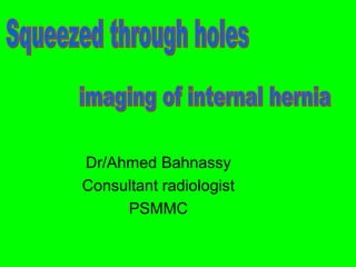Dr/Ahmed Bahnassy 
Consultant radiologist 
PSMMC 
 