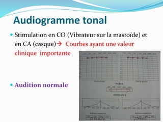 Audiogramme tonal
 Stimulation en CO (Vibrateur sur la mastoïde) et
en CA (casque) Courbes ayant une valeur
clinique importante
 Audition normale
 