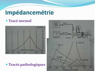 Impédancemétrie
 Tracé normal
 Tracés pathologiques
 