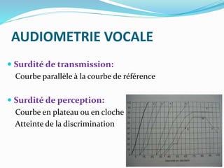 AUDIOMETRIE VOCALE
 Surdité de transmission:
Courbe parallèle à la courbe de référence
 Surdité de perception:
Courbe en plateau ou en cloche
Atteinte de la discrimination
 