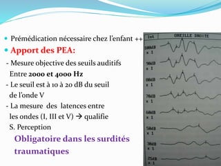  Prémédication nécessaire chez l’enfant ++
 Apport des PEA:
- Mesure objective des seuils auditifs
Entre 2000 et 4000 Hz
- Le seuil est à 10 à 20 dB du seuil
de l’onde V
- La mesure des latences entre
les ondes (I, III et V)  qualifie
S. Perception
Obligatoire dans les surdités
traumatiques
 