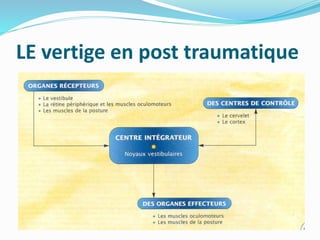 LE vertige en post traumatique
 