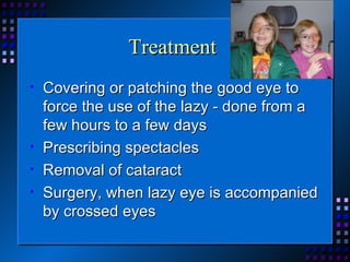 Treatment  Covering or patching the good eye to force the use of the lazy - done from a few hours to a few days  Prescribing spectacles  Removal of cataract Surgery, when lazy eye is accompanied by crossed eyes 