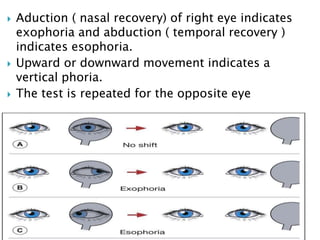  Aduction ( nasal recovery) of right eye indicates
exophoria and abduction ( temporal recovery )
indicates esophoria.
 Upward or downward movement indicates a
vertical phoria.
 The test is repeated for the opposite eye
 