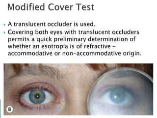 A translucent occluder is used.
 Covering both eyes with translucent occluders
permits a quick preliminary determination of
whether an esotropia is of refractive –
accommodative or non-accommodative origin.
 