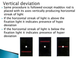  Same procedure is followed except maddox rod is
placed with its axes vertically producing horizontal
streak of light
 If the horizontal streak of light is above the
fixation light it indicates presence of hypo
deviation
 If the horizontal streak of light is below the
fixation light it indicates presence of hyper
deviation
 