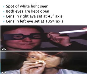  Spot of white light seen
 Both eyes are kept open
 Lens in right eye set at 45o
axis
 Lens in left eye set at 135o axis
 