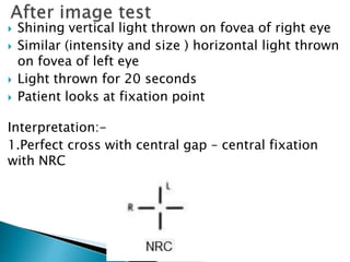  Shining vertical light thrown on fovea of right eye
 Similar (intensity and size ) horizontal light thrown
on fovea of left eye
 Light thrown for 20 seconds
 Patient looks at fixation point
Interpretation:-
1.Perfect cross with central gap – central fixation
with NRC
 