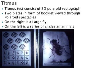  Titmus test consist of 3D polaroid vectograph
 Two plates in form of booklet viewed through
Polaroid spectacles
 On the right is a Large fly
 On the left is a series of circles an animals
 