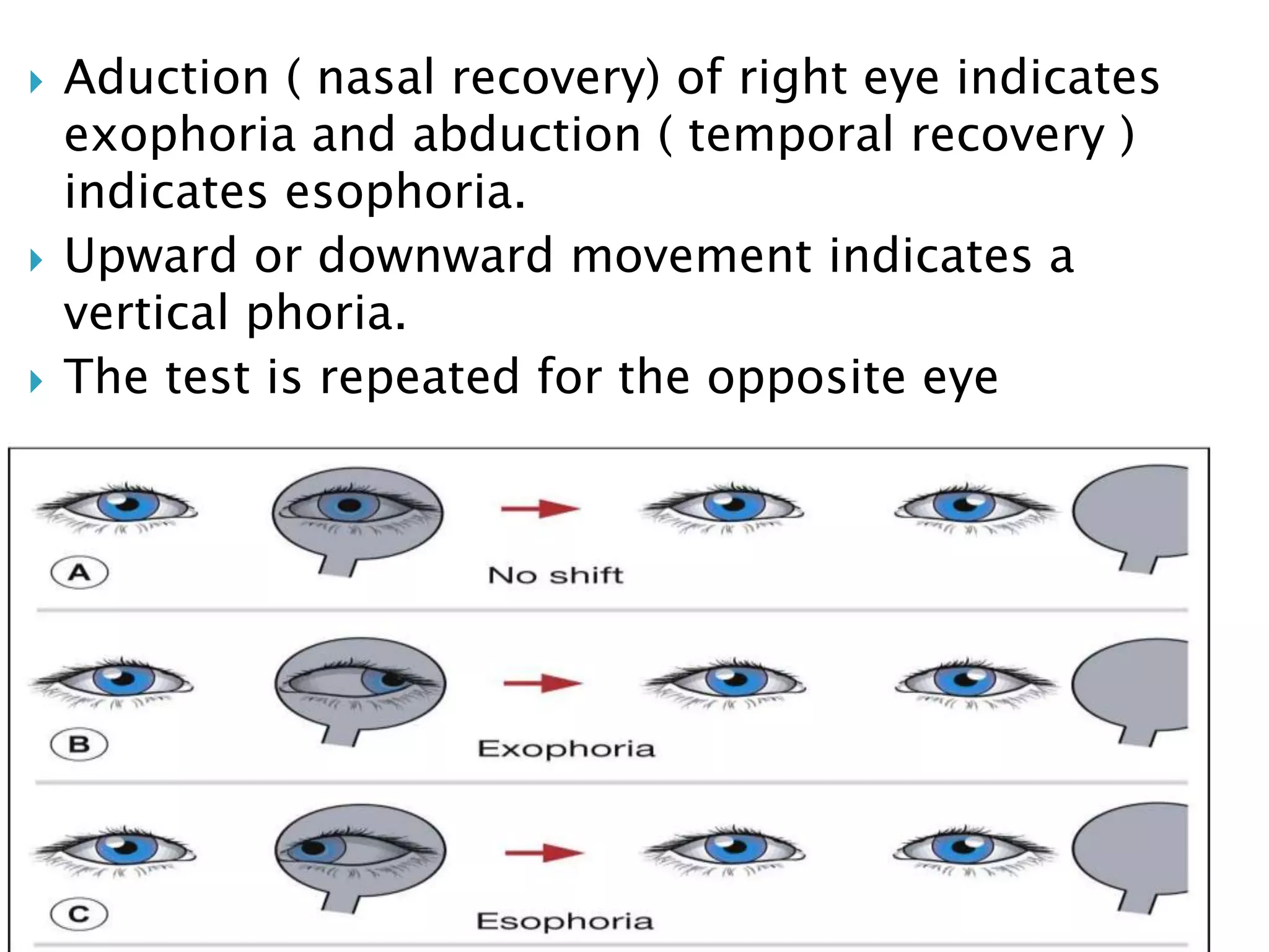  Aduction ( nasal recovery) of right eye indicates
exophoria and abduction ( temporal recovery )
indicates esophoria.
 Upward or downward movement indicates a
vertical phoria.
 The test is repeated for the opposite eye
 
