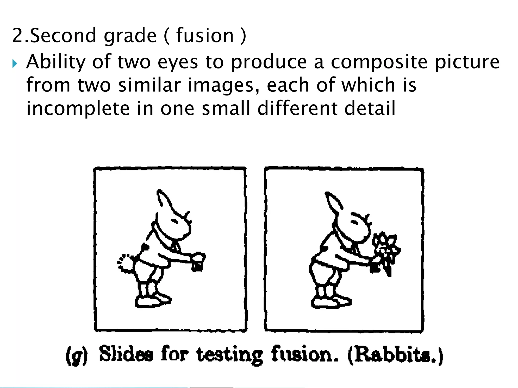 2.Second grade ( fusion )
 Ability of two eyes to produce a composite picture
from two similar images, each of which is
incomplete in one small different detail
 