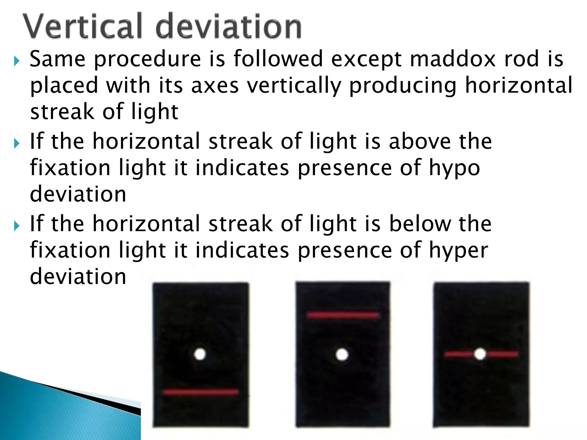  Same procedure is followed except maddox rod is
placed with its axes vertically producing horizontal
streak of light
 If the horizontal streak of light is above the
fixation light it indicates presence of hypo
deviation
 If the horizontal streak of light is below the
fixation light it indicates presence of hyper
deviation
 