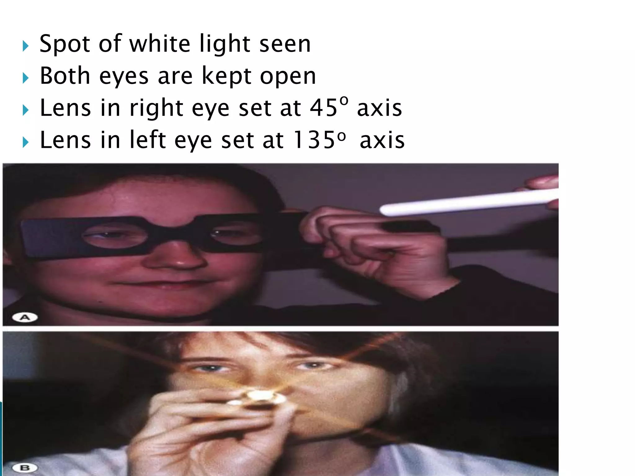  Spot of white light seen
 Both eyes are kept open
 Lens in right eye set at 45o
axis
 Lens in left eye set at 135o axis
 